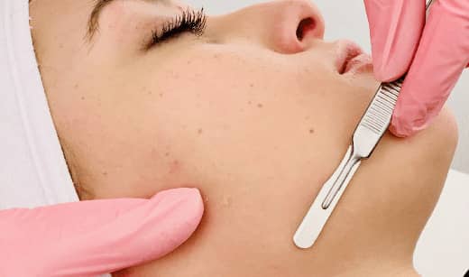 dermaplane
